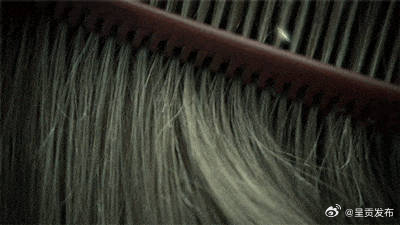 女性脱发建议去查查内分泌