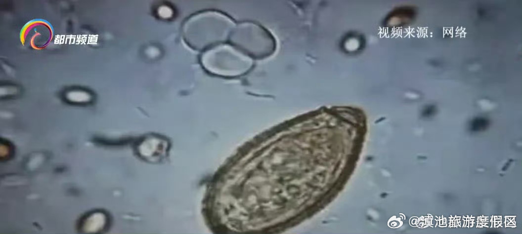 滇池旅游度假区