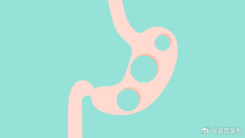 空腹吃这些食物会得胃结石