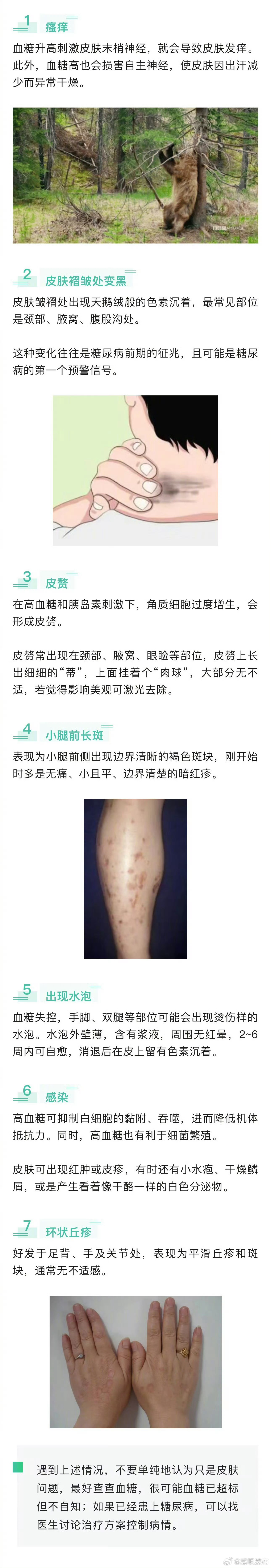 皮肤出现7个变化提示血糖超标