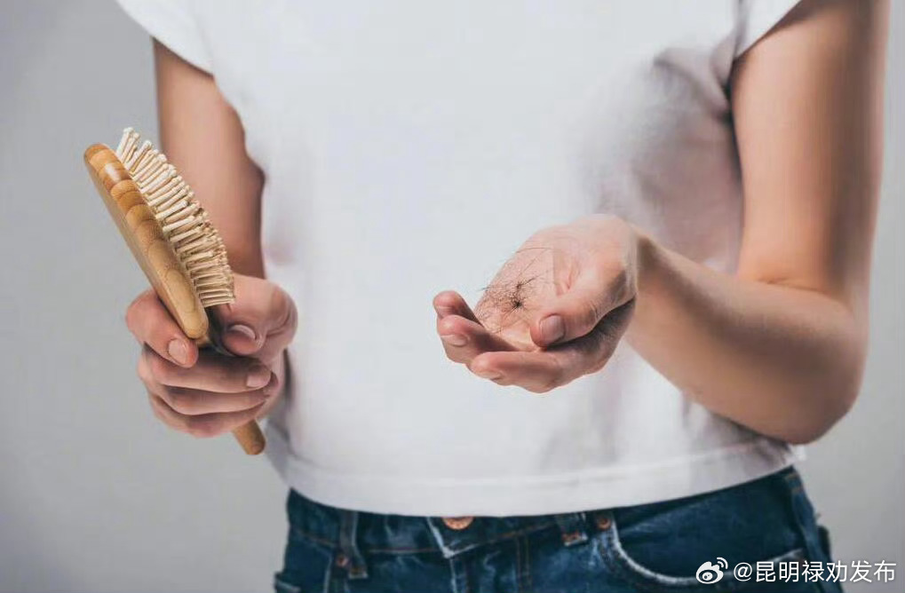 大多数产后脱发可以自愈