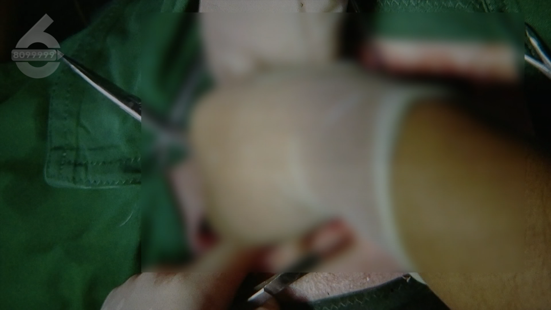 8099999街头巷尾微信