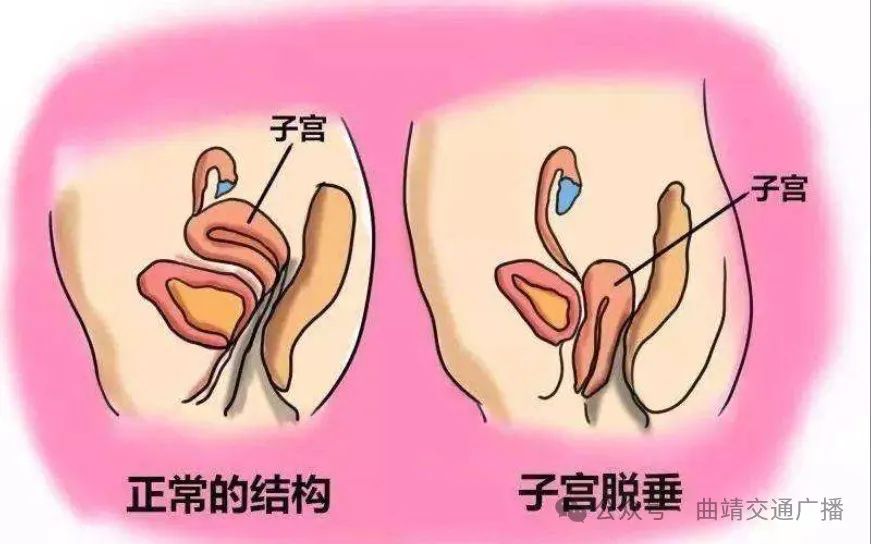 曲靖市妇幼保健院