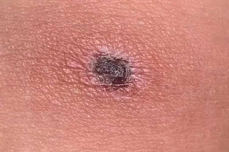 昆明市第一人民医院