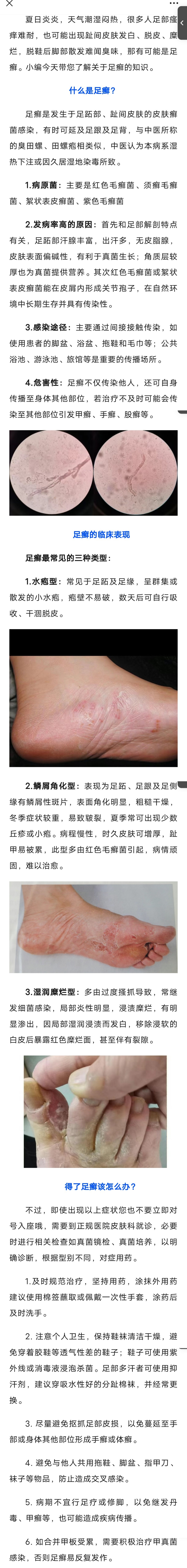 夏日炎炎，您的脚丫还好吗？