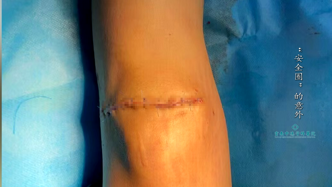 8099999街头巷尾微信