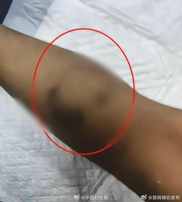 三岁男童被生父女友虐待致脑死亡?警方:已刑拘