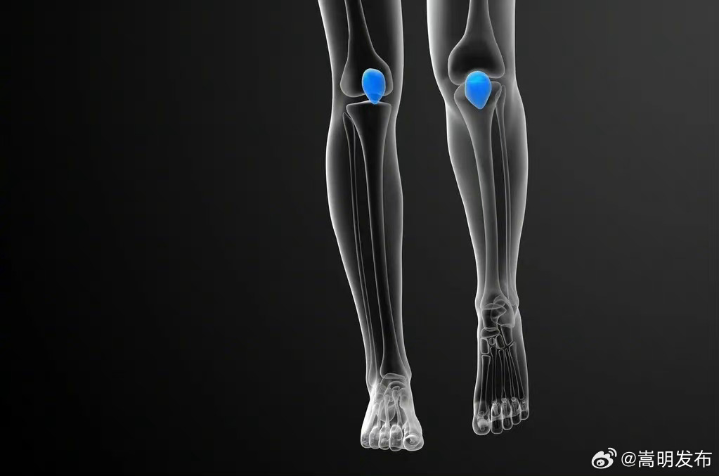 打软腿可能是髌骨变软了