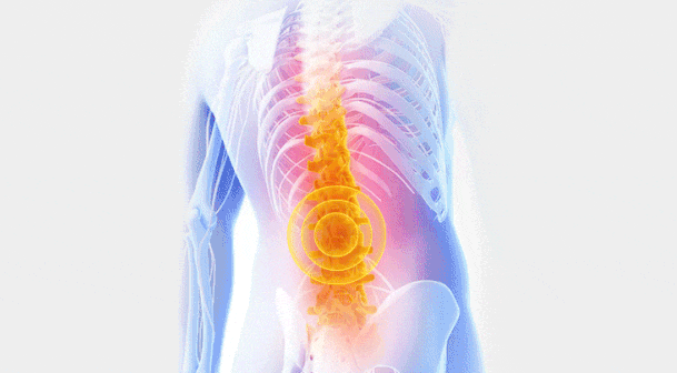 经常侧躺可能让脊柱越来越弯 