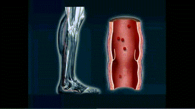 小腿粗壮的人心脏更好