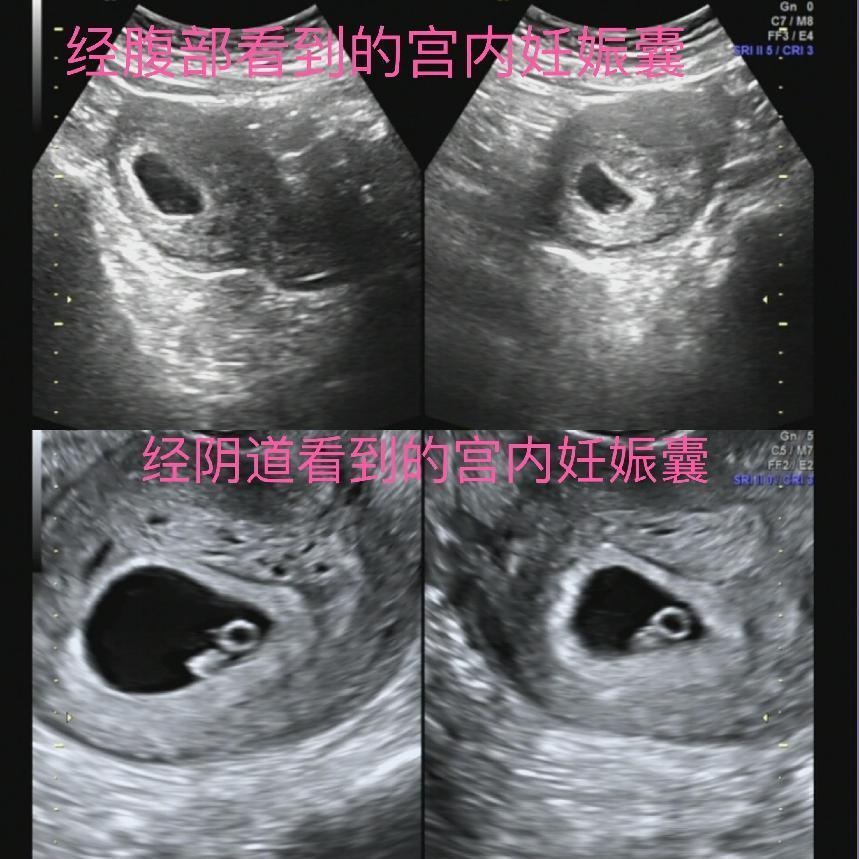 昆明市妇幼保健院