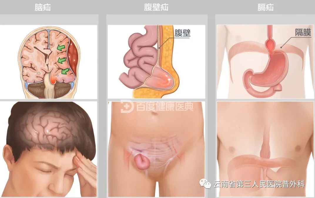 云南省第三人民医院