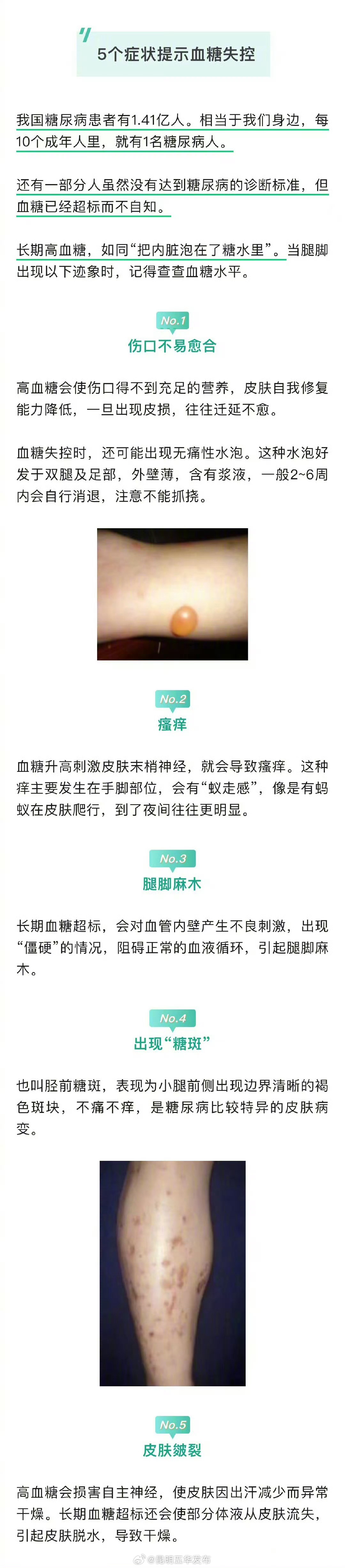 腿脚是人体自带的血糖仪