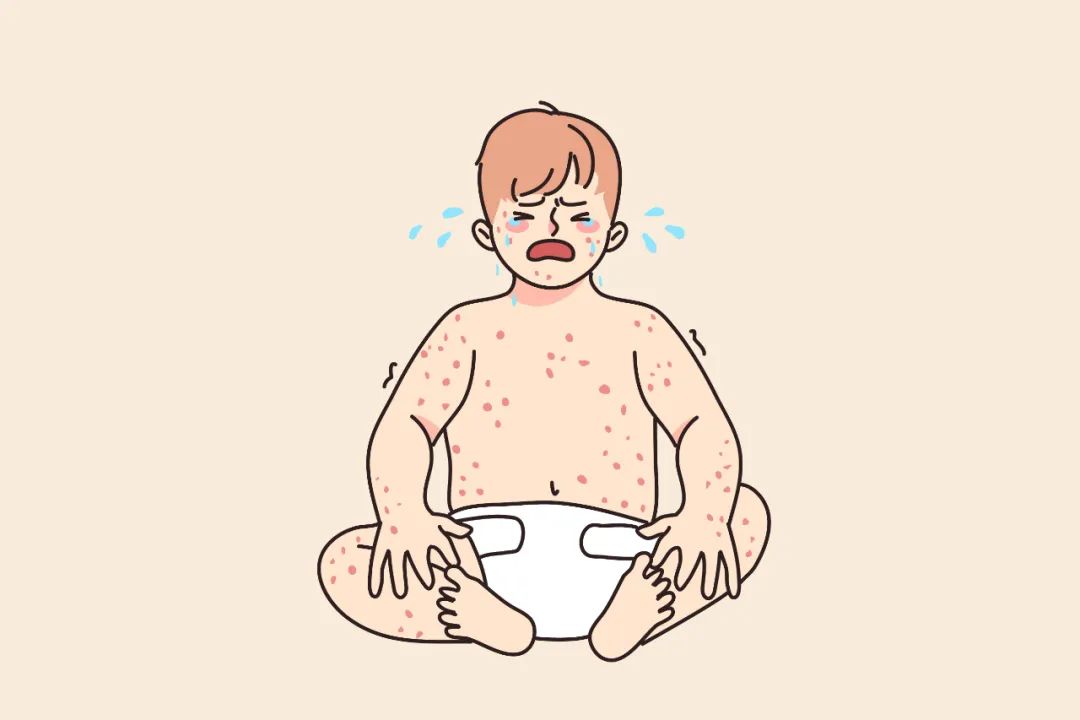 云南疾控