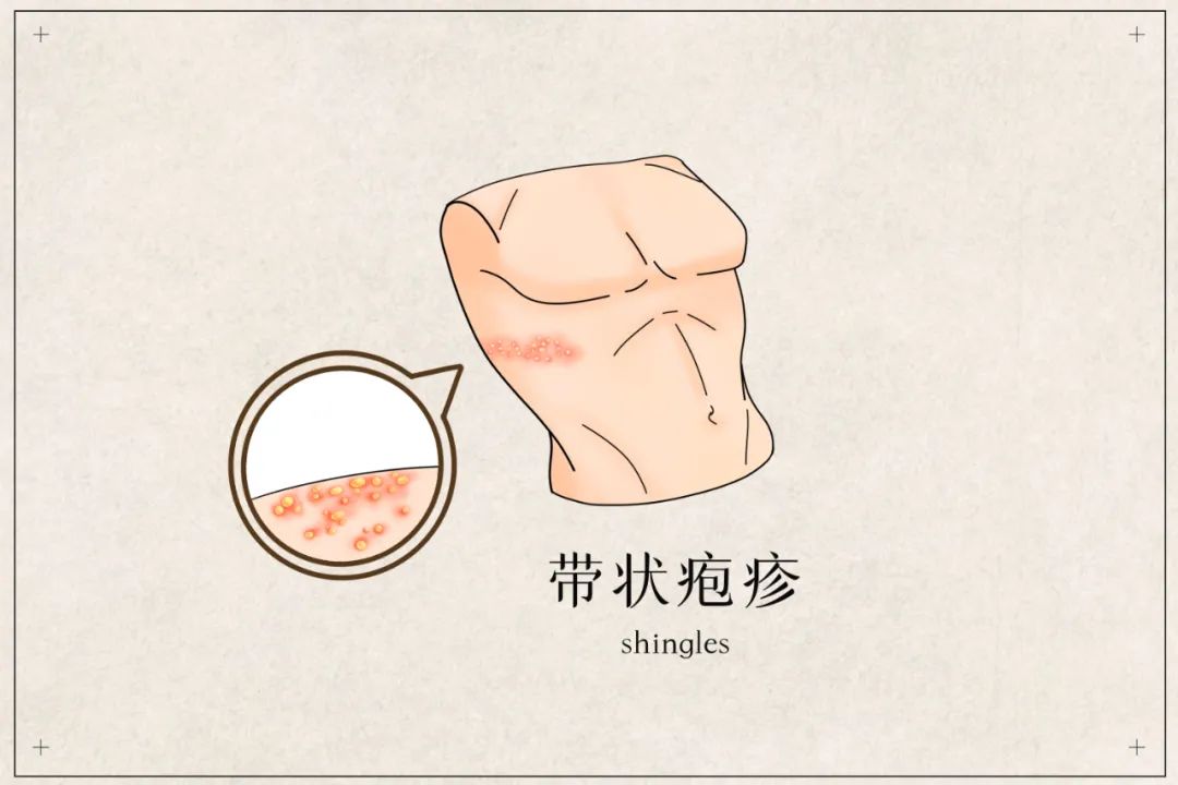 云南疾控
