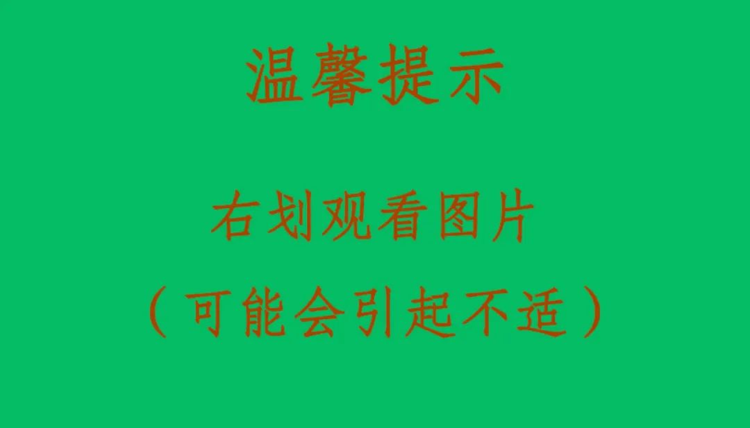 普洱市人民医院