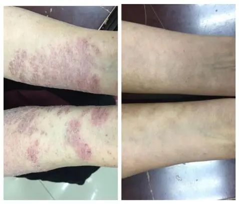 云南省中医医院