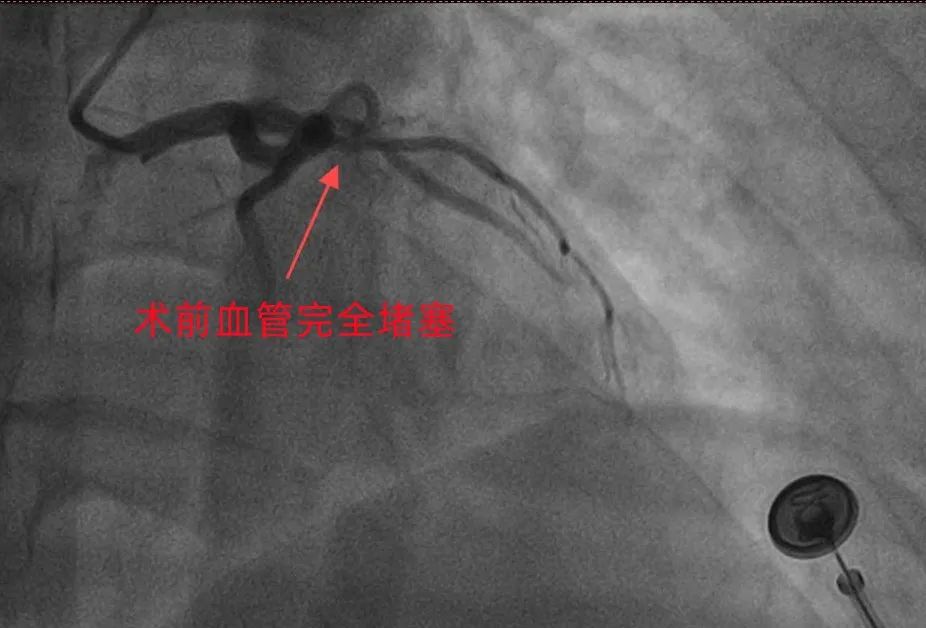 云南省文山州人民医院