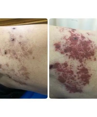 云南省中医医院