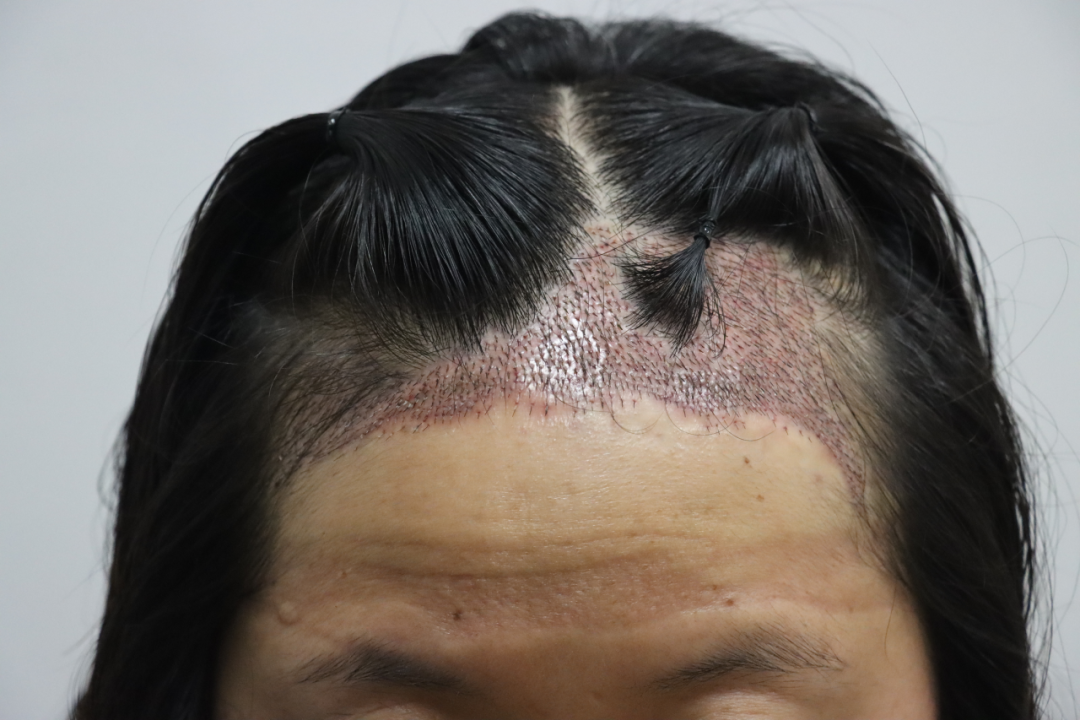 昆明市第一人民医院