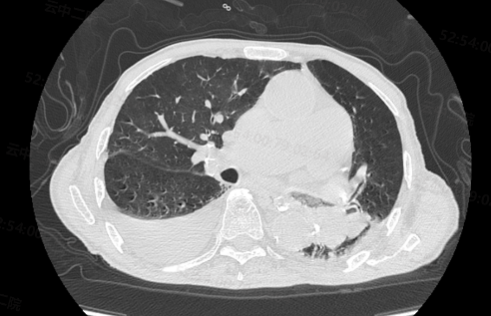 云南中医药大学第二附属医院