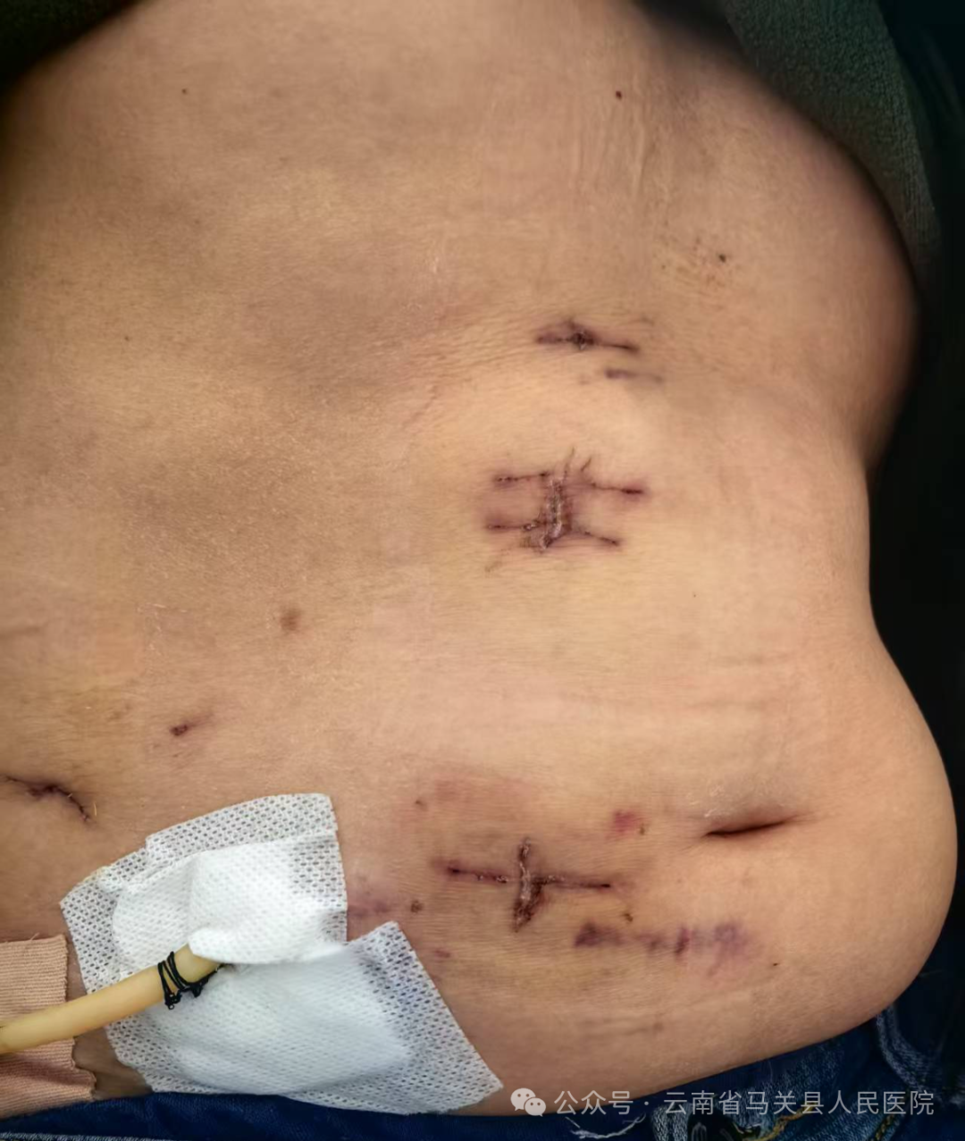 云南省马关县人民医院