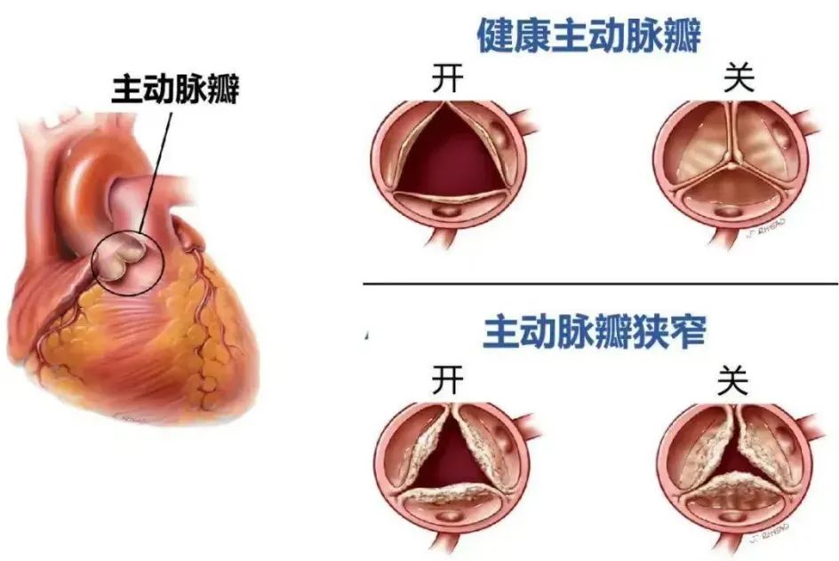 普洱市人民医院