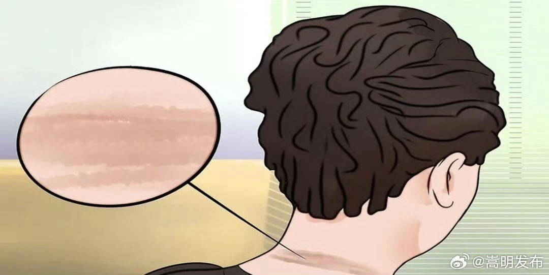 原来长胖是有预兆的