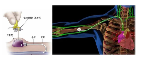 昆明市第一人民医院
