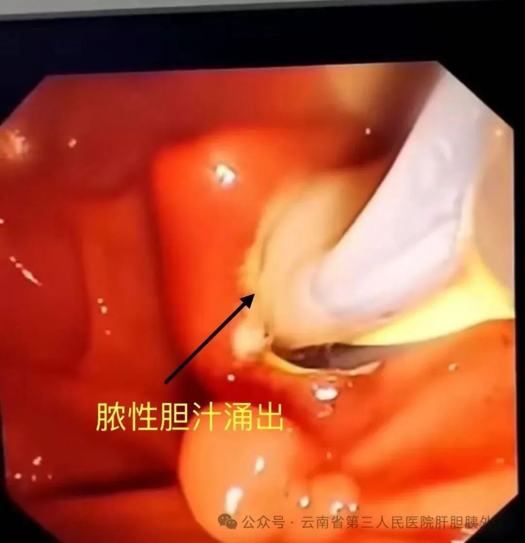 云南省第三人民医院