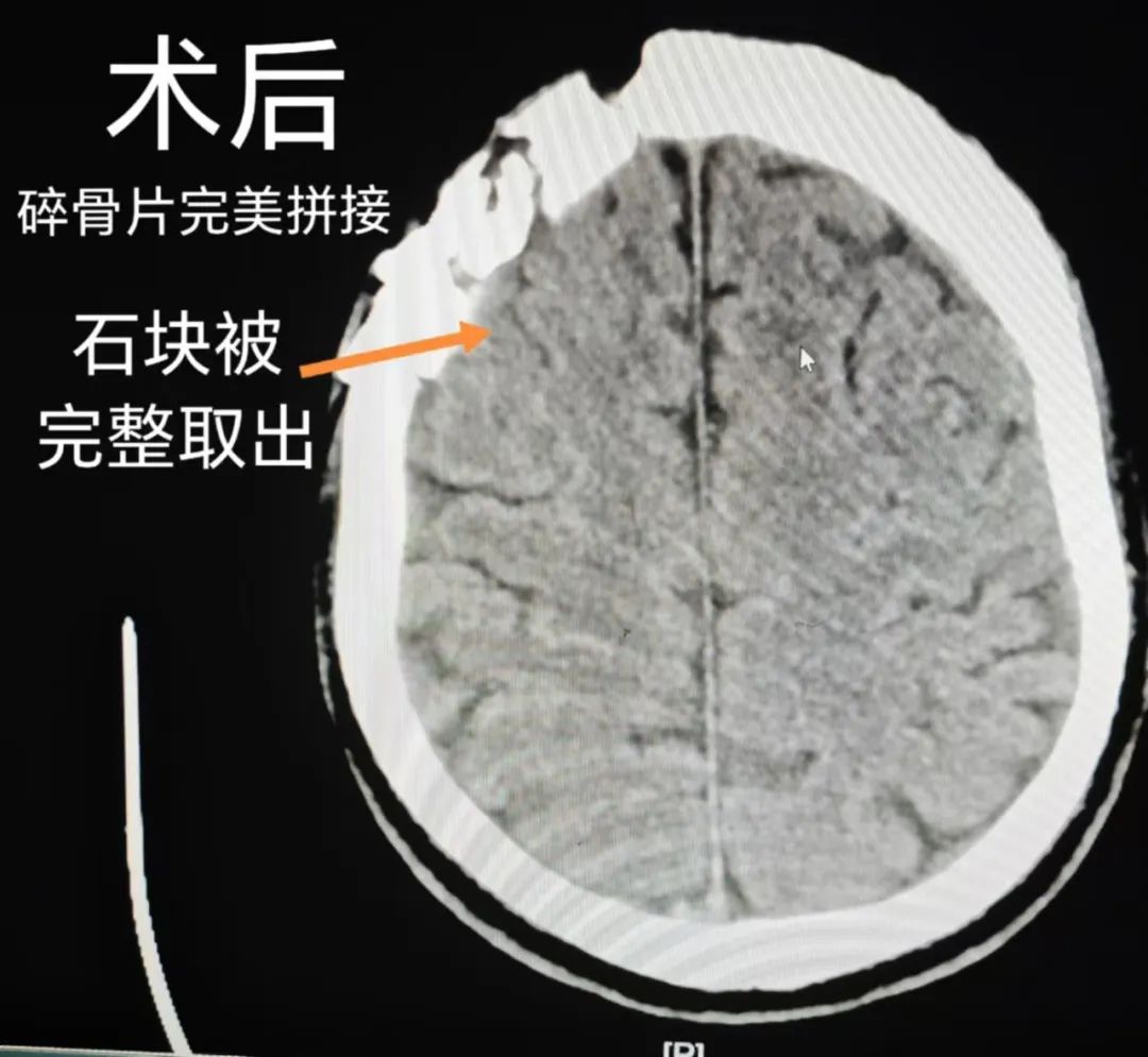 普洱市人民医院
