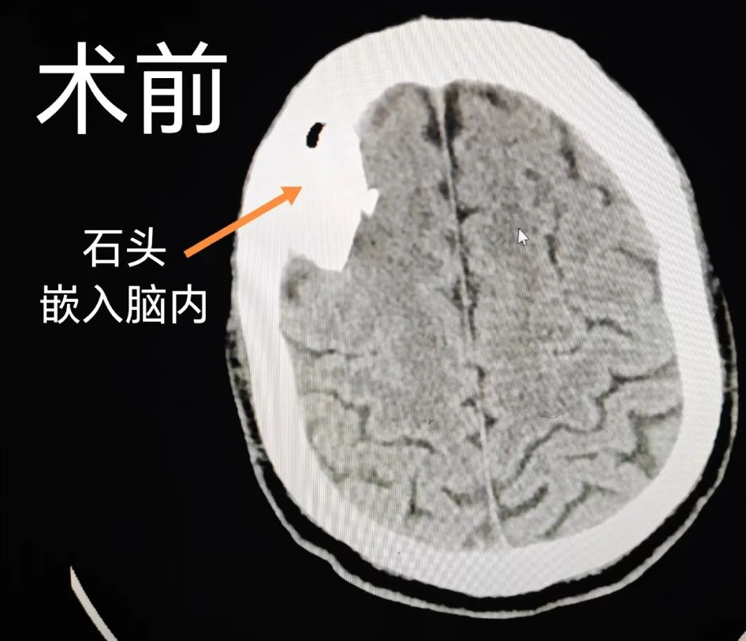 普洱市人民医院