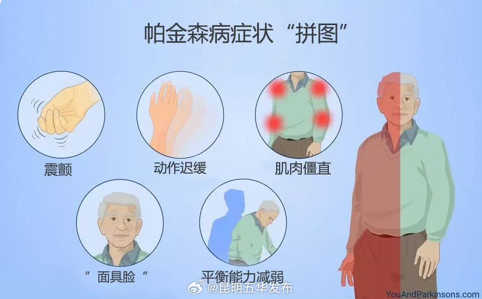 9个问题识别帕金森早期信号