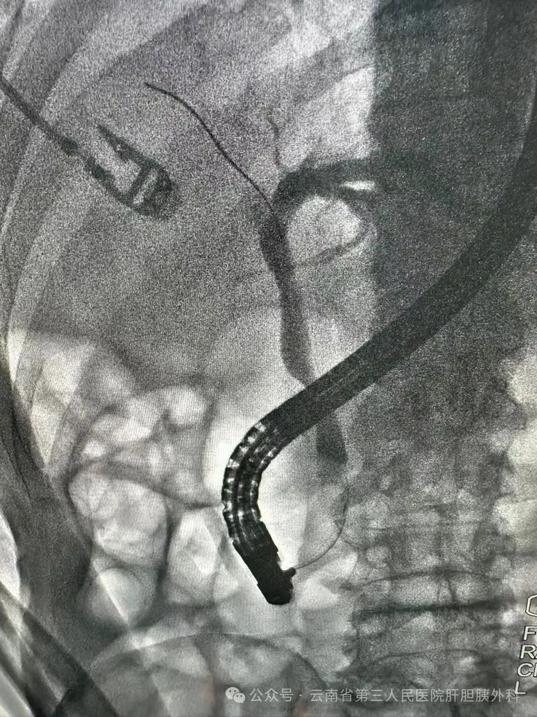 云南省第三人民医院