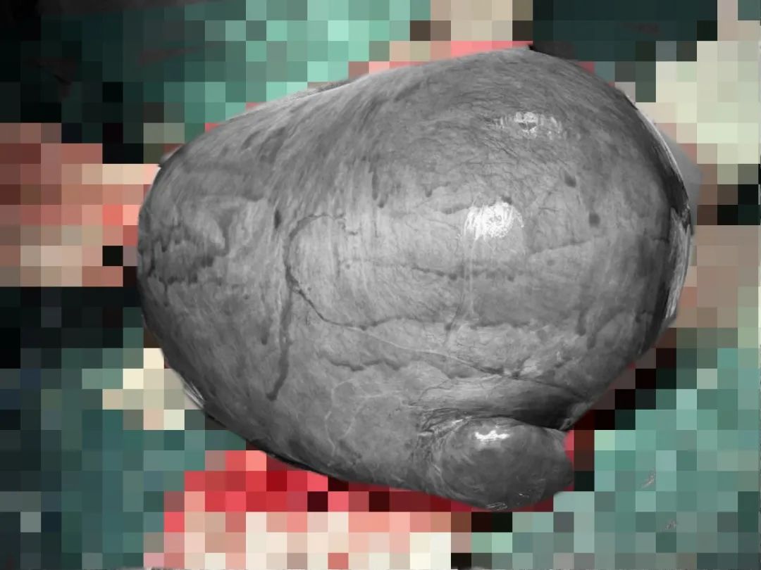 云南省第三人民医院