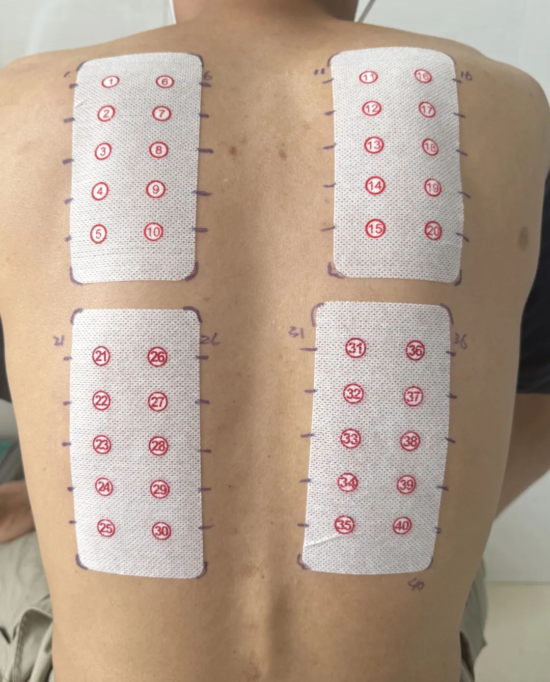 普洱市人民医院