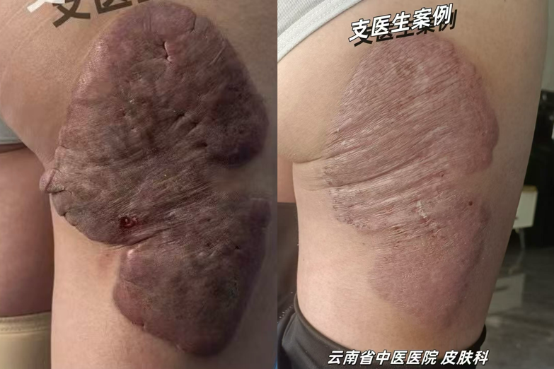 云南省中医医院