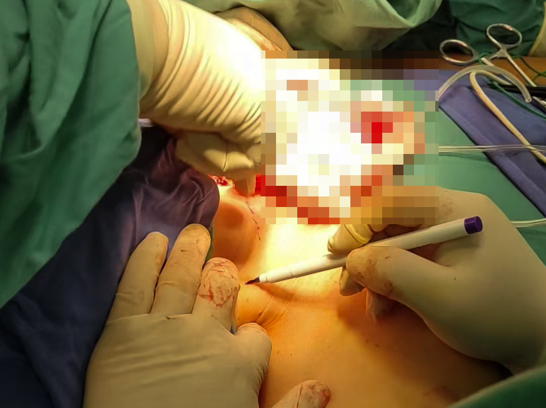 普洱市人民医院