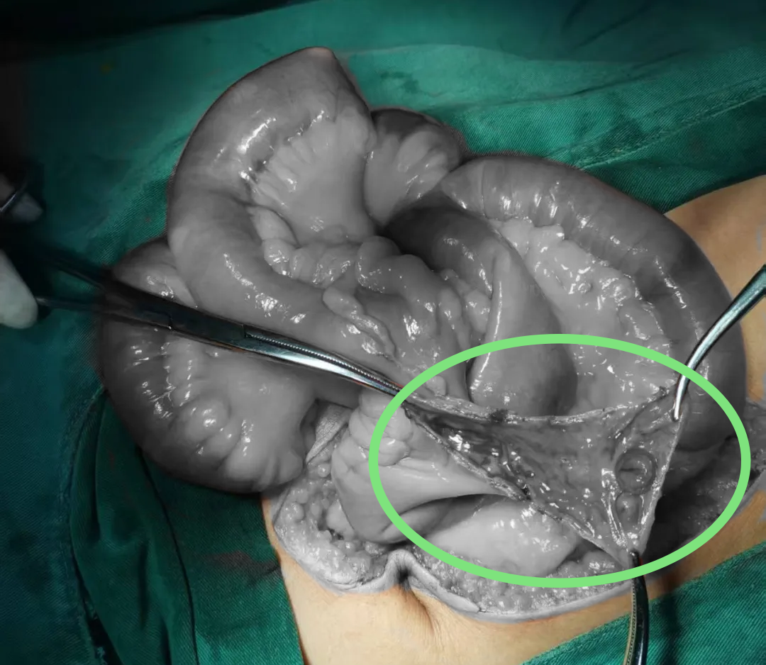 云南省第三人民医院