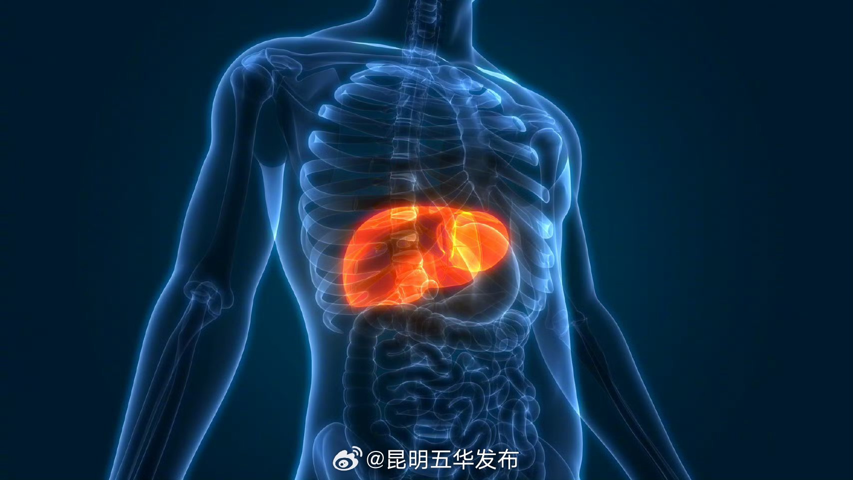 得了脂肪肝最忌讳快速减肥