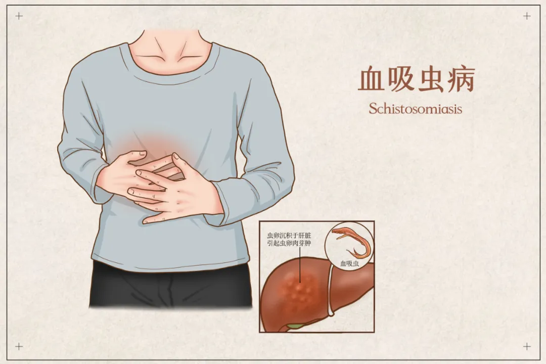 云南疾控