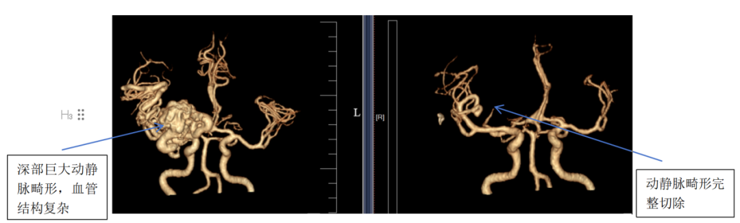 普洱市人民医院