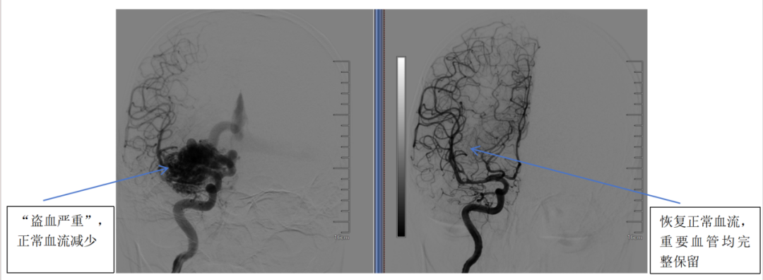 普洱市人民医院