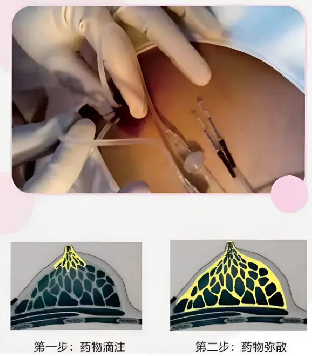 云南省第三人民医院