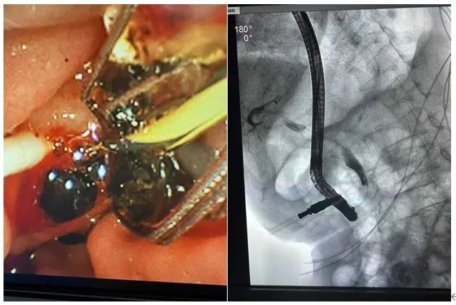 云南省第三人民医院