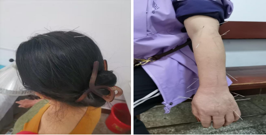 云南省文山州人民医院