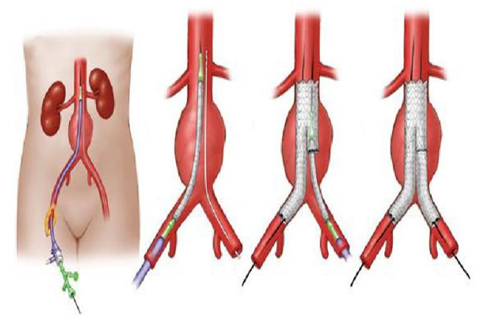 普洱市人民医院