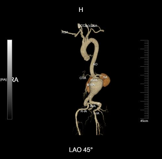 普洱市人民医院