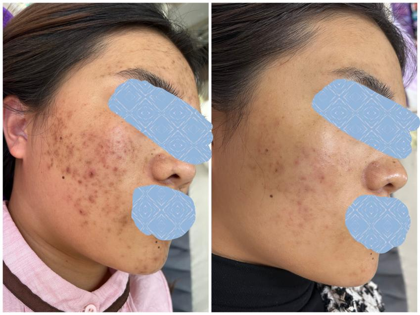 镇雄县人民医院