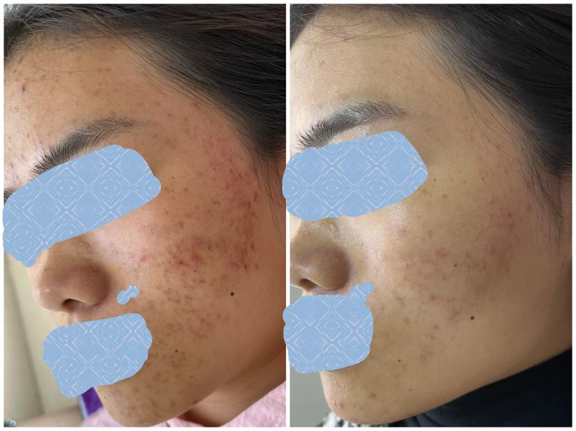 镇雄县人民医院